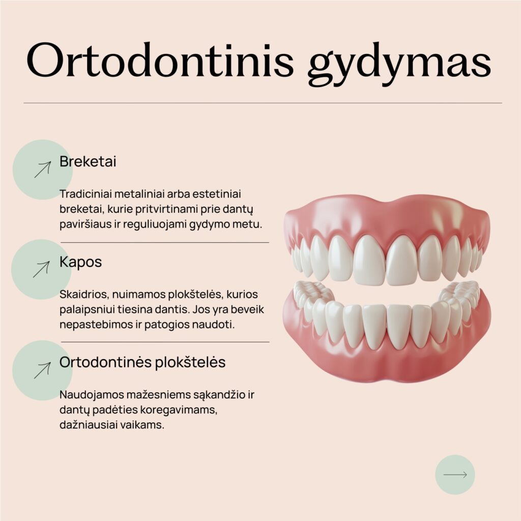 socialinių tinklų dizainas